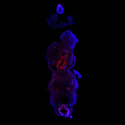 PDLIM3 gene expression in a CS16 human embryonic heart